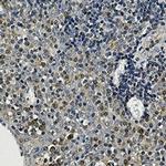 TUBA4A Antibody in Immunohistochemistry (Paraffin) (IHC (P))