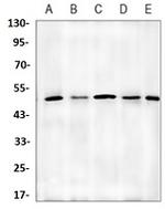 TUBA4A Antibody in Western Blot (WB)