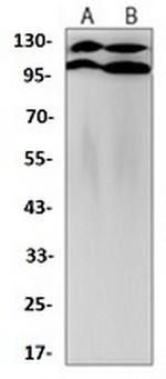 APOER2 Recombinant Rabbit Monoclonal Antibody