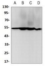 TUBB Antibody in Western Blot (WB)