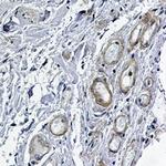 PRKACA Antibody in Immunohistochemistry (Paraffin) (IHC (P))