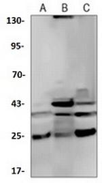 CASP4 Recombinant Rabbit Monoclonal Antibody