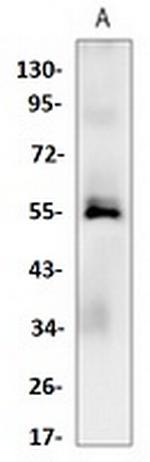 Casp8 Recombinant Rabbit Monoclonal Antibody