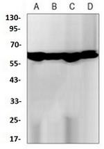 CAT Antibody in Western Blot (WB)