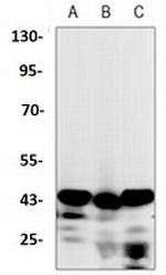 Ctsb Antibody in Western Blot (WB)