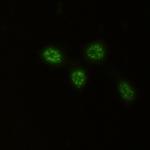 CHEK2 Recombinant Rabbit Monoclonal Antibody