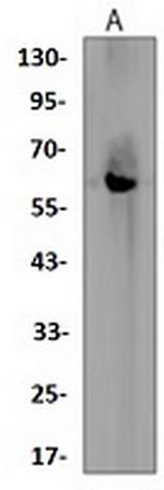 CHEK2 Antibody in Western Blot (WB)
