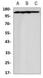 COL3A1 Antibody in Western Blot (WB)