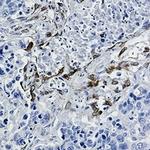 PTGS2 Recombinant Rabbit Monoclonal Antibody