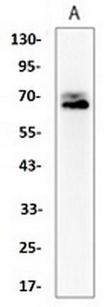 PTGS2 Antibody in Western Blot (WB)