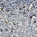 CCNE2 Antibody in Immunohistochemistry (Paraffin) (IHC (P))
