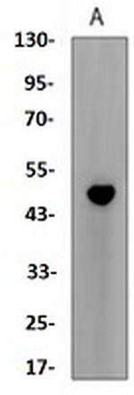 CCNE2 Antibody in Western Blot (WB)