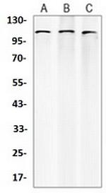 CTNND1 Antibody in Western Blot (WB)