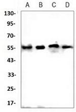 GSDME Recombinant Rabbit Monoclonal Antibody
