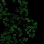 E2F1 Recombinant Rabbit Monoclonal Antibody