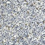 E2F1 Antibody in Immunohistochemistry (Paraffin) (IHC (P))