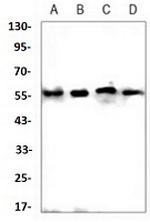 E2F1 Antibody in Western Blot (WB)
