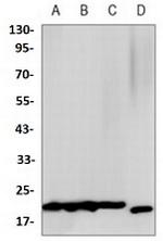 EIF4EBP1 Antibody in Western Blot (WB)