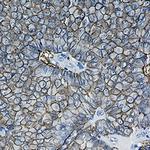 EPCAM Antibody in Immunohistochemistry (Paraffin) (IHC (P))
