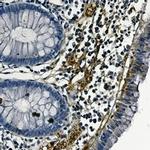 PTK2 Antibody in Immunohistochemistry (Paraffin) (IHC (P))