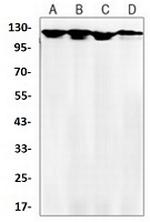 PTK2 Antibody in Western Blot (WB)