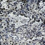 FAS Antibody in Immunohistochemistry (Paraffin) (IHC (P))