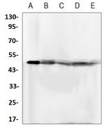 FKBP4 Antibody in Western Blot (WB)