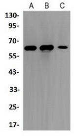 FOXO4 Recombinant Rabbit Monoclonal Antibody