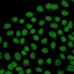 FTO Recombinant Rabbit Monoclonal Antibody