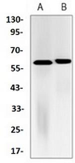 FTO Antibody in Western Blot (WB)