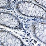 FUBP1 Antibody in Immunohistochemistry (Paraffin) (IHC (P))