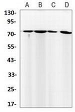 FUBP1 Antibody in Western Blot (WB)