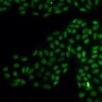 NR3C1 Recombinant Rabbit Monoclonal Antibody
