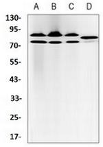 NR3C1 Antibody in Western Blot (WB)