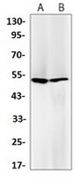 GSR Recombinant Rabbit Monoclonal Antibody