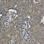 GRP78 Recombinant Rabbit Monoclonal Antibody