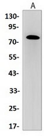 GRP78 Antibody in Western Blot (WB)