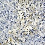 HK2 Antibody in Immunohistochemistry (Paraffin) (IHC (P))