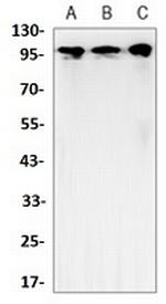 HK2 Antibody in Western Blot (WB)