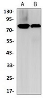 HSF1 Antibody in Western Blot (WB)