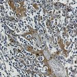 HSPA1A Antibody in Immunohistochemistry (Paraffin) (IHC (P))