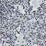 ILF3 Antibody in Immunohistochemistry (Paraffin) (IHC (P))