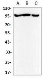 ILF3 Antibody in Western Blot (WB)