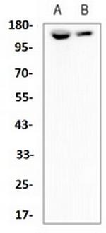ITGA5 Antibody in Western Blot (WB)