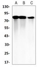 ITGB5 Recombinant Rabbit Monoclonal Antibody