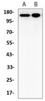 JAK2 Recombinant Rabbit Monoclonal Antibody