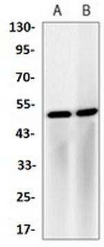 NR1H3 Antibody in Western Blot (WB)