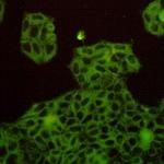 MET Recombinant Rabbit Monoclonal Antibody