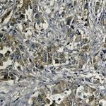 MET Antibody in Immunohistochemistry (Paraffin) (IHC (P))