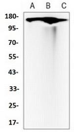 MET Antibody in Western Blot (WB)
